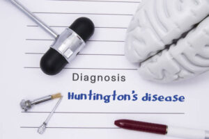 Huntington's disease symptoms - Newstrendline.Com